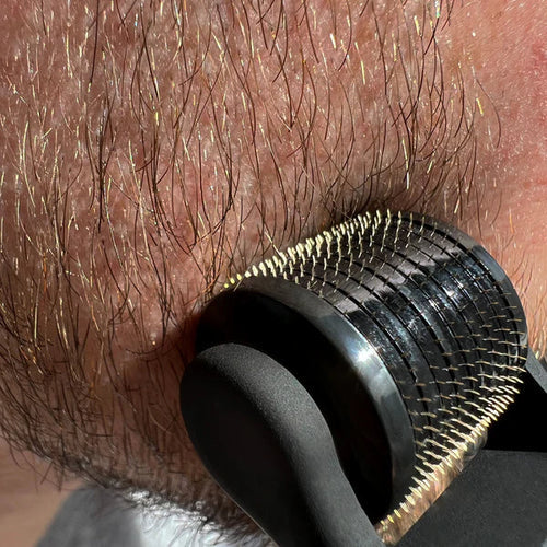 How to use a derma roller for beard growth