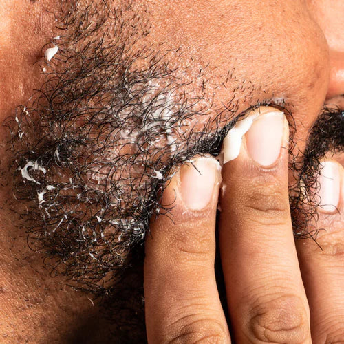 5 tips against irritated and itchy beards